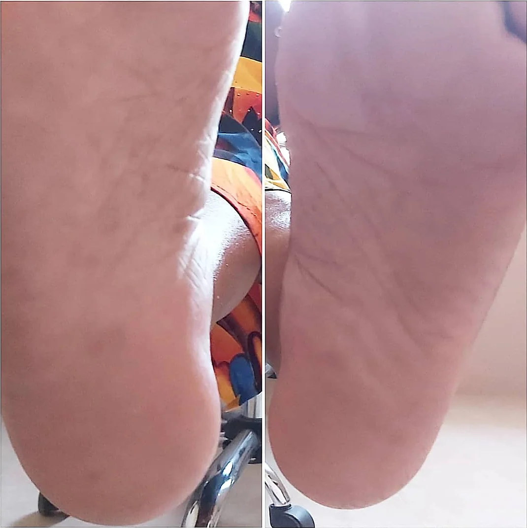 Heels before and after smoothing