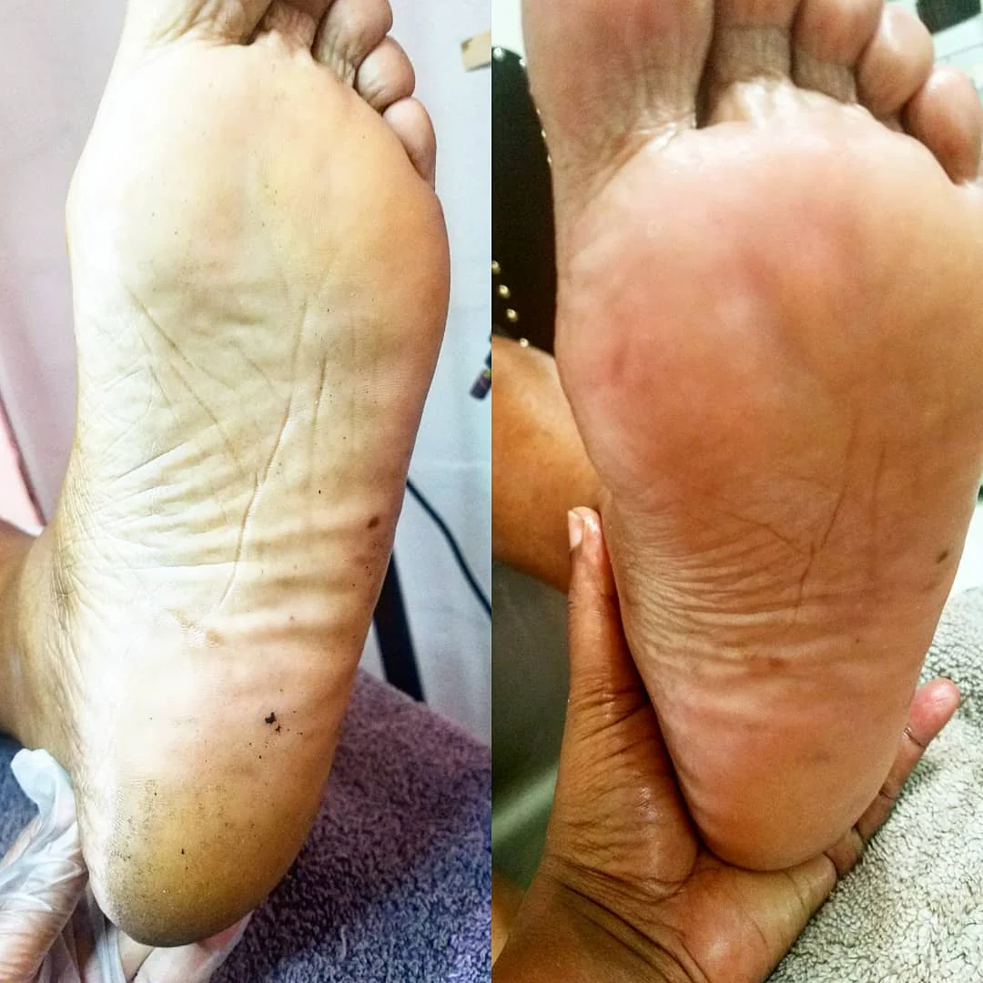 Soles before and after sole care